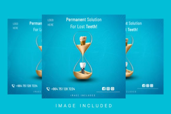 Download Dental Implantation Social Media Post - Media post Collection